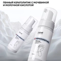 Пенный кератолик RuNail с мочевиной и молочной кислотой, 150 мл №9875 9875