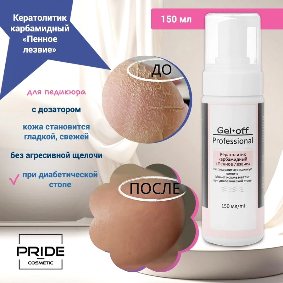 PRIDE cosmetic Кератолитик карбамидный «Пенное лезвие » для педикюра с дозатором, 150 мл Pr/2022